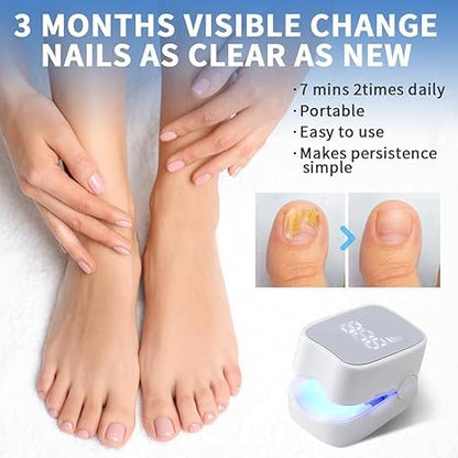 Hengulus Nail Fungus Treatment Light – Rechargeable Blue & Red Therapy Device